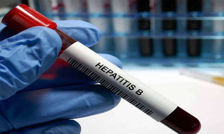 BUMDC organises workshop for screening of Hepatitis