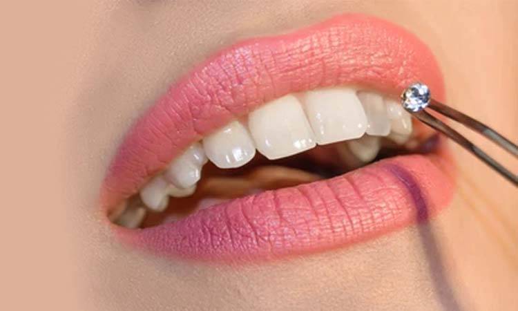 The cosmo-dentist makes smiles sparkle with tooth jewel