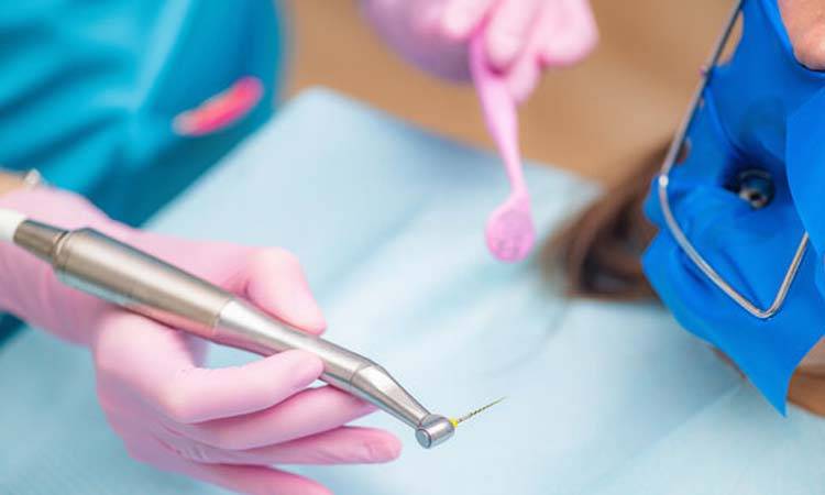 Rotary Endodontics: The Effective Root Canal Treatment