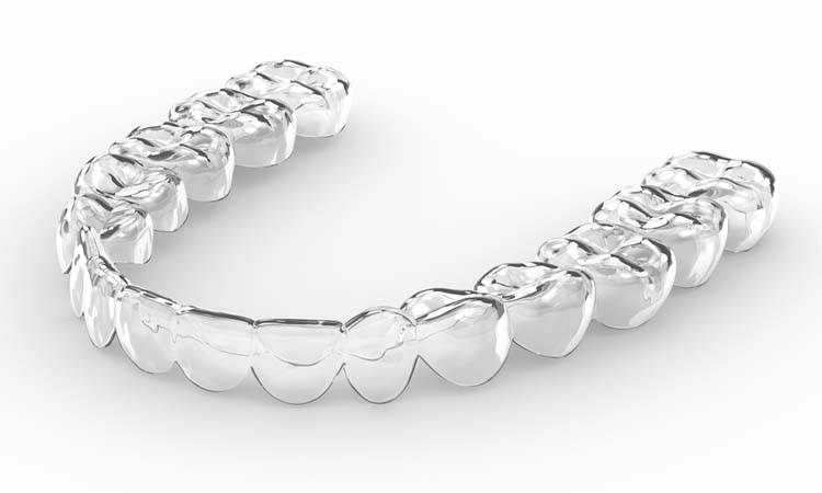 Global Market Size of Orthodontic Supplies to $10.23 Billion By 2028