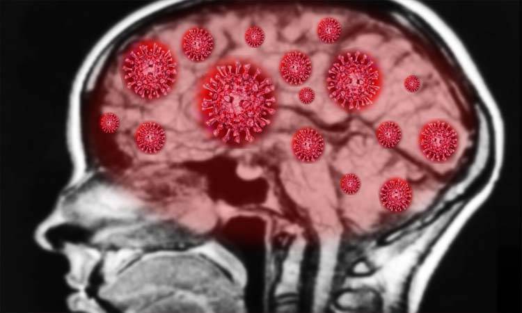 Teenagers become paranoid after COVID-19 antibodies attack their brains 