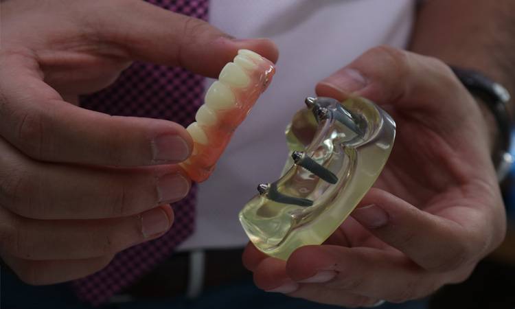 University College of Dentistry workshop demonstrates All-on-4® Implants