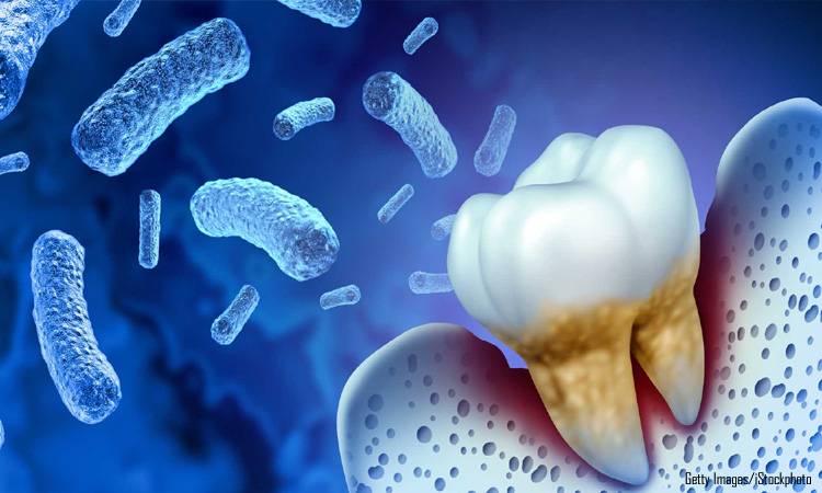 Can a tooth infection affect other regions of the body?