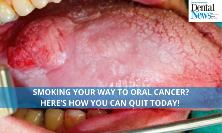 Smoking Your Way to Oral Cancer? Here’s How You Can Quit Today! 