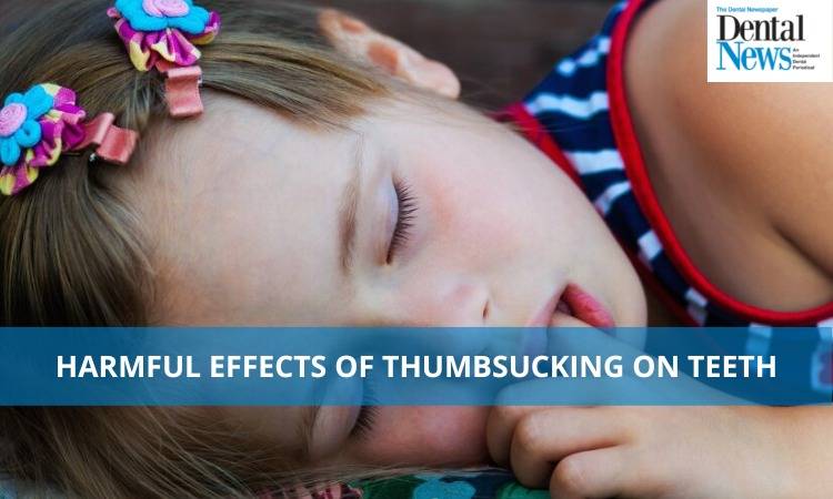 The Harmful Effects of Thumb Sucking on Teeth