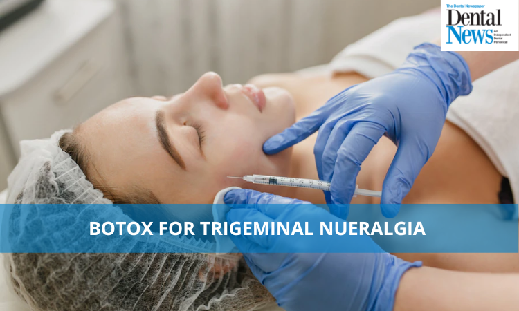 Botox for Trigeminal Neuralgia