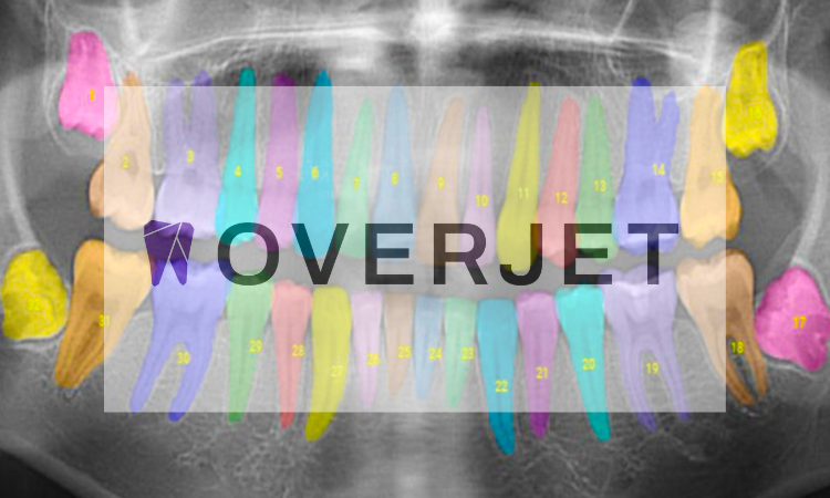 Overjet and Dental AI expand into Canada