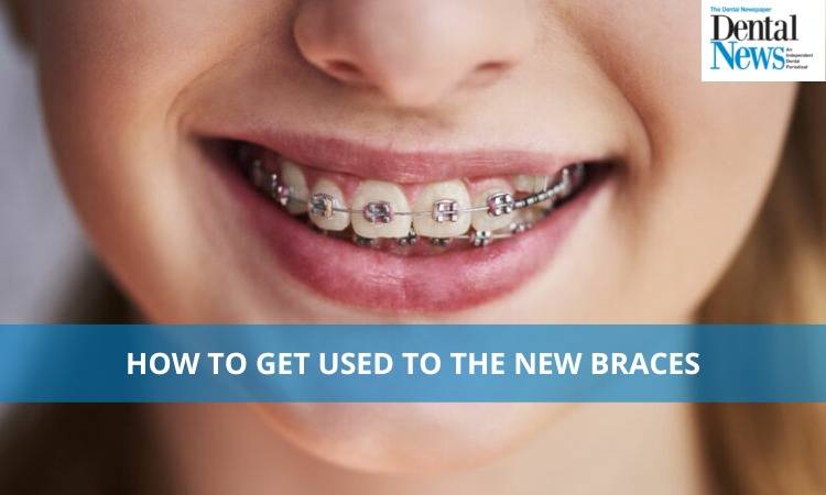 How to get used to the new braces