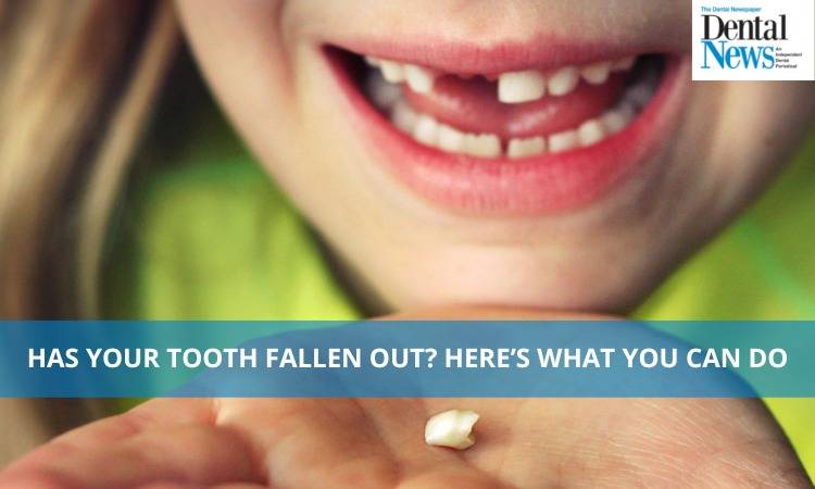 Has Your Tooth Fallen Out? Here’s What You Can Do?