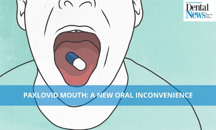 Paxlovid Mouth: A New Oral Inconvenience