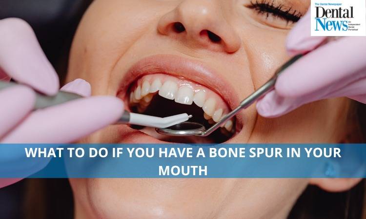 What to do if you have a bone spur in your mouth
