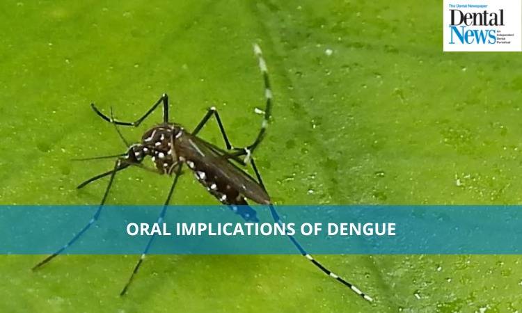 Oral Implications of Dengue