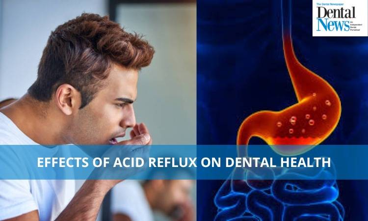 Effects of acid reflux on dental health