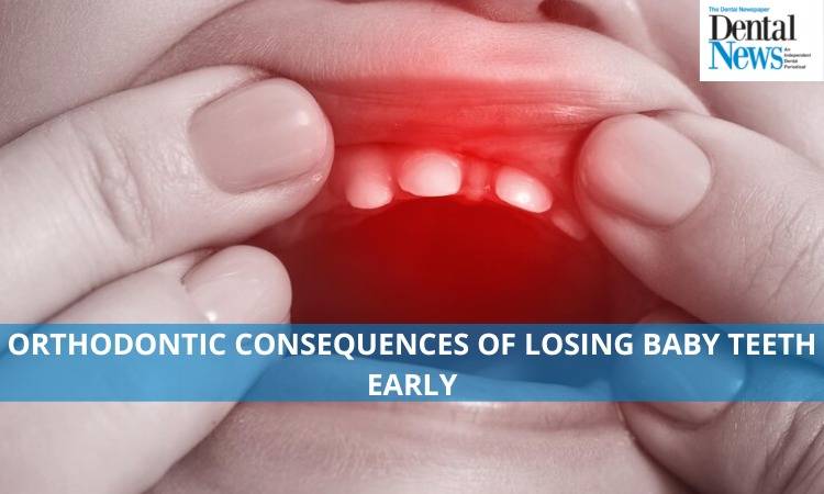 Orthodontic consequences of losing baby teeth early