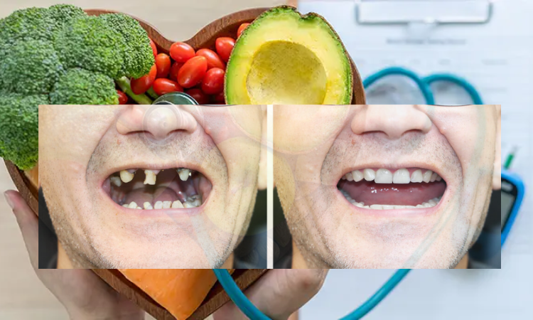 Wearing dentures may prevent a person’s nutrition