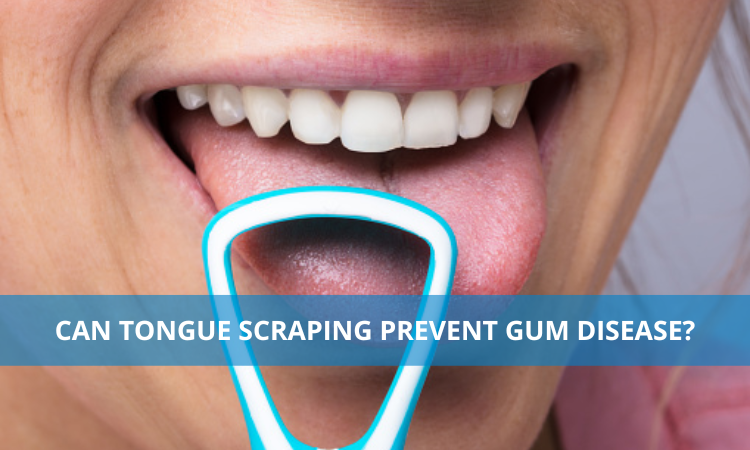  Can Tongue Scraping Prevent Gum Disease? 
