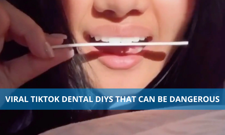 Viral Tiktok Dental DIYs That Can Be Dangerous