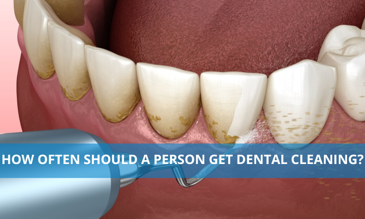 How often should a person get dental cleaning?