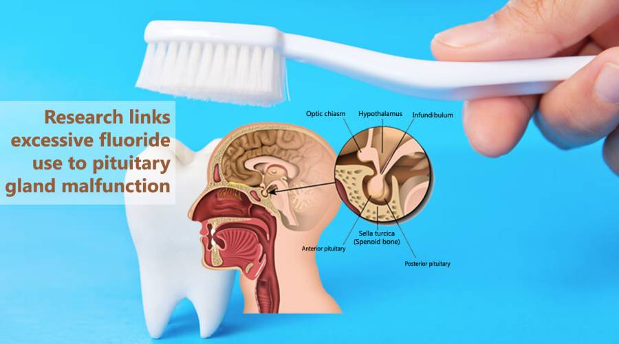 Research links excessive fluoride use to pituitary gland malfunction  