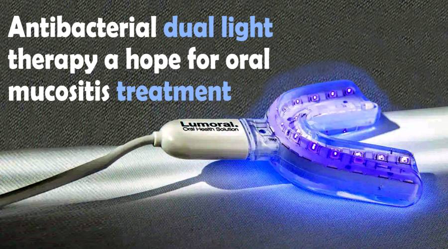 Antibacterial dual light therapy a hope for oral mucositis treatment 