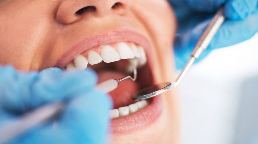 Research on using oral bacteria transplant to prevent tooth decay 